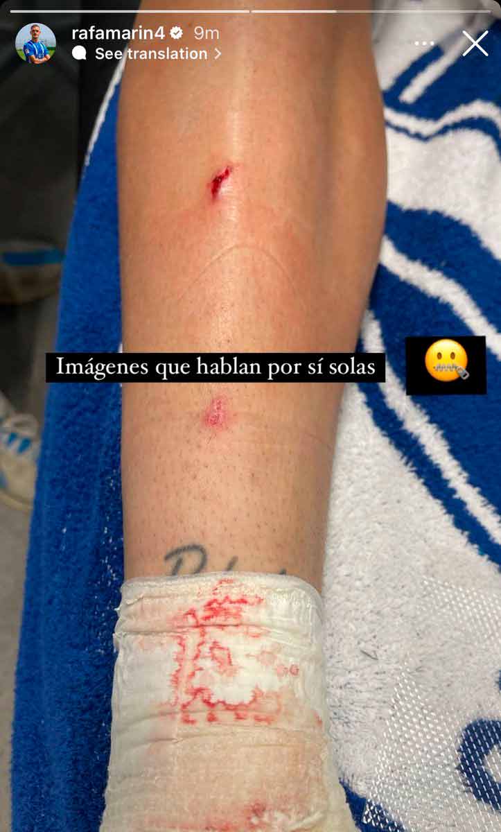 Pierna de Rafa Marín tras la entrada de Vitor Roque